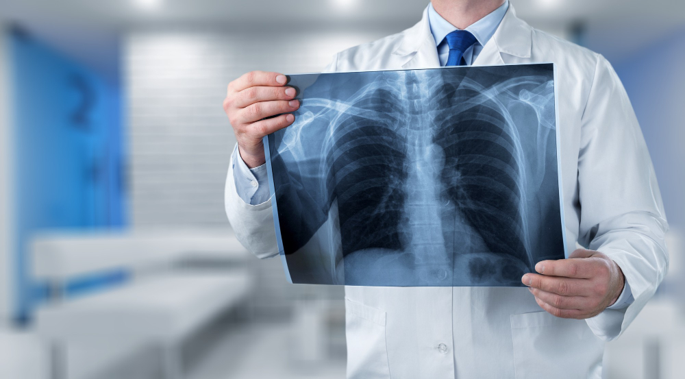 Digital X-Ray Imaging in Vinings, GA